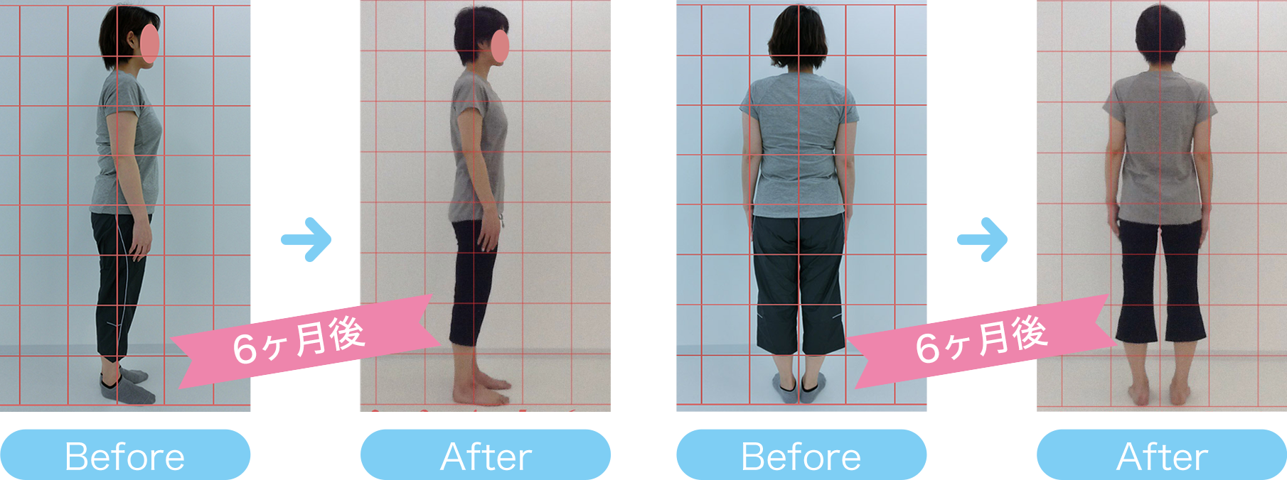 C様体型変化の写真