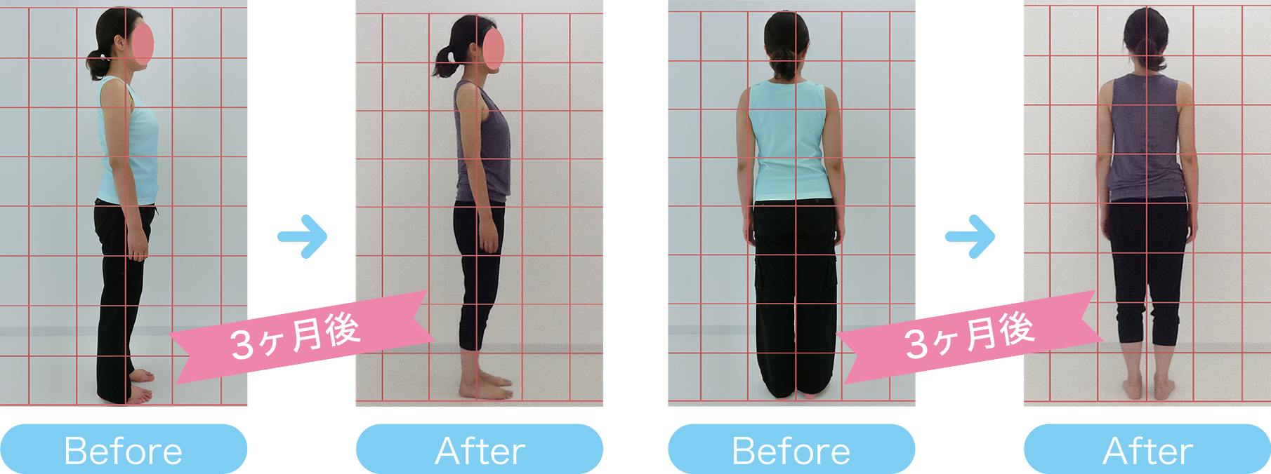 B様体型変化の写真