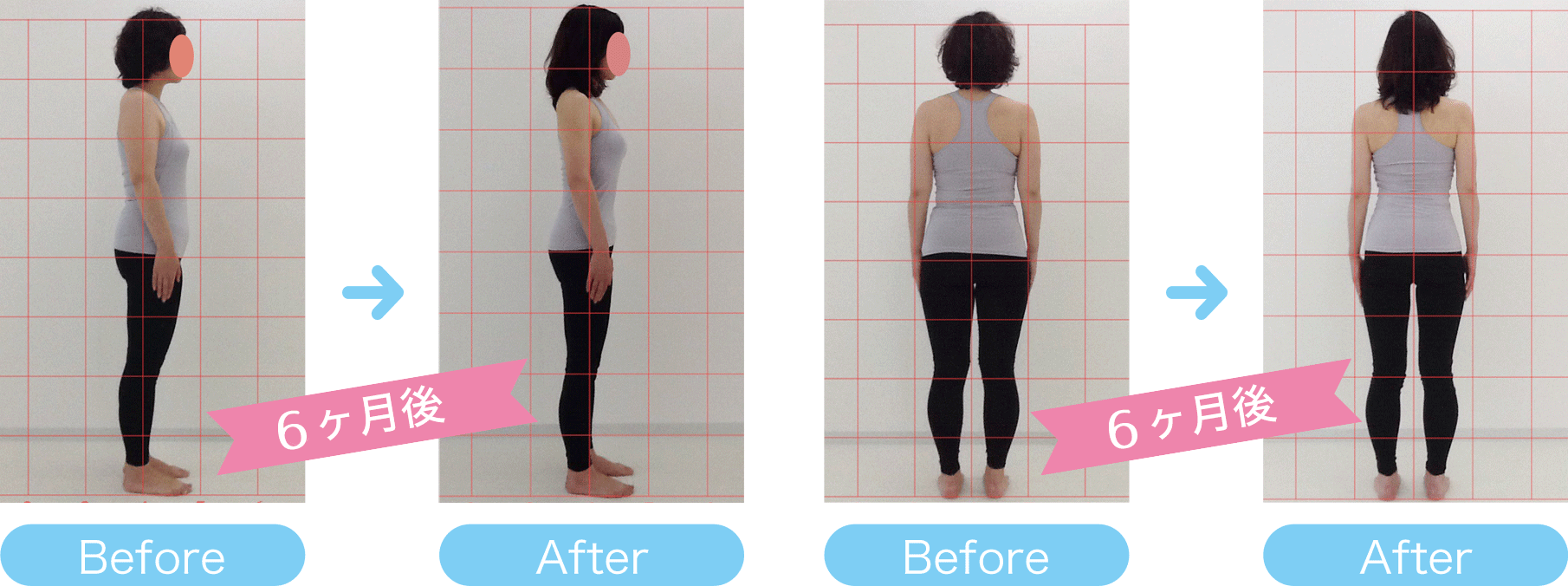 A様体型変化の写真